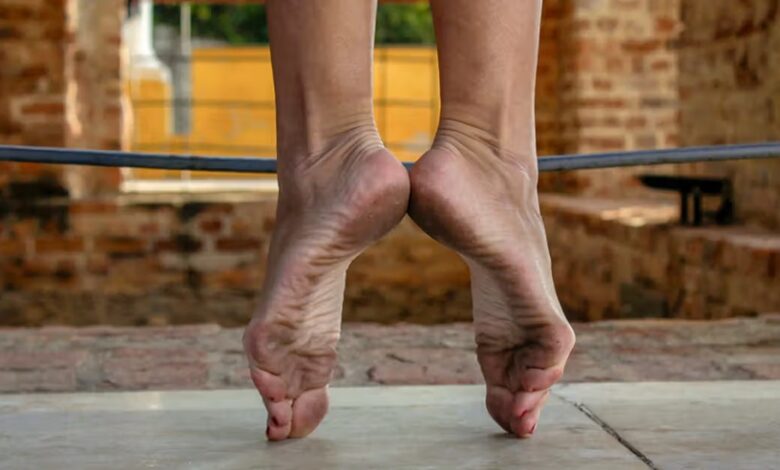 Hallux limitus symptoms